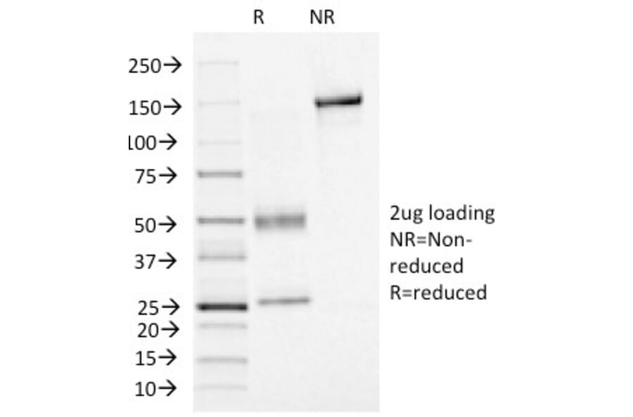 SDS-PAGE - Anti-FOXA1 Antibody [FOXA1/1515] - BSA and Azide free (A252044) - Antibodies.com