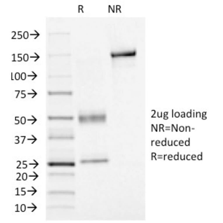 SDS-PAGE - Anti-FOXA1 Antibody [FOXA1/1515] - BSA and Azide free (A252044) - Antibodies.com