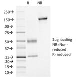 SDS-PAGE - Anti-FOXA1 Antibody [FOXA1/1515] - BSA and Azide free (A252044) - Antibodies.com