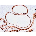 Immunohistochemistry - Anti-FOXA1 Antibody [FOXA1/1516] - BSA and Azide free (A252045) - Antibodies.com