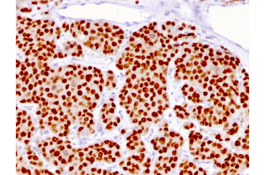 Immunohistochemistry - Anti-FOXA1 Antibody [FOXA1/1516] - BSA and Azide free (A252044) - Antibodies.com