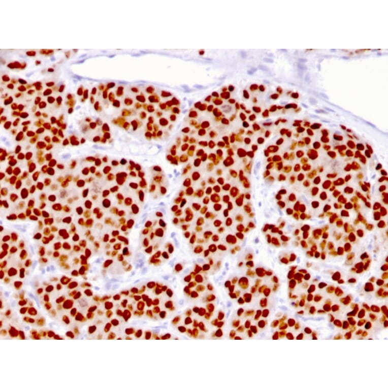 Immunohistochemistry - Anti-FOXA1 Antibody [FOXA1/1516] - BSA and Azide free (A252044) - Antibodies.com