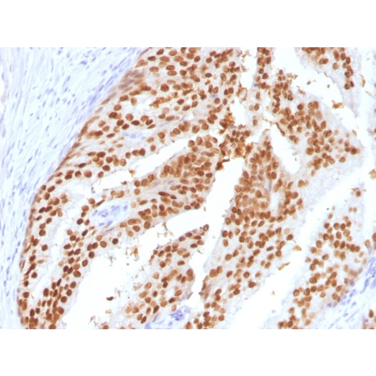 Immunohistochemistry - Anti-FOXA1 Antibody [FOXA1/1516] - BSA and Azide free (A252045) - Antibodies.com
