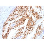 Immunohistochemistry - Anti-FOXA1 Antibody [FOXA1/1516] - BSA and Azide free (A252045) - Antibodies.com