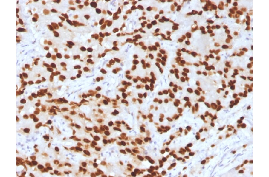 Immunohistochemistry - Anti-FOXA1 Antibody [FOXA1/1516] - BSA and Azide free (A252045) - Antibodies.com