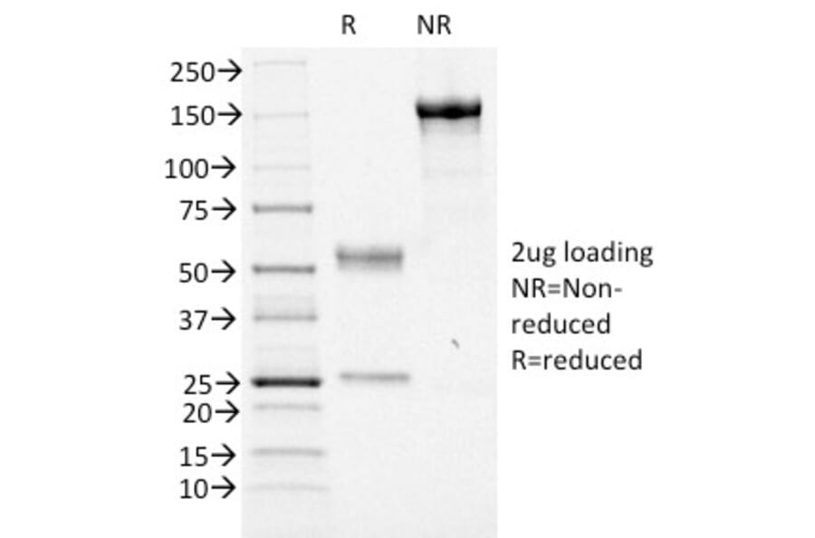 SDS-PAGE - Anti-FOXA1 Antibody [FOXA1/1516] - BSA and Azide free (A252045) - Antibodies.com