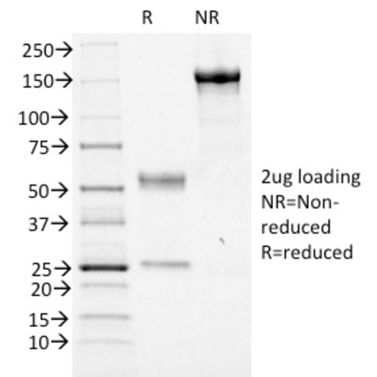 SDS-PAGE - Anti-FOXA1 Antibody [FOXA1/1516] - BSA and Azide free (A252045) - Antibodies.com