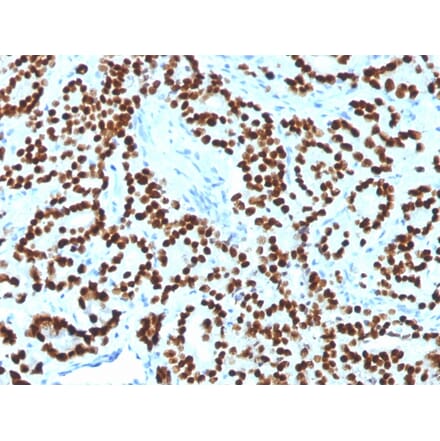 Immunohistochemistry - Anti-FOXA1 Antibody [FOXA1/1518] - BSA and Azide free (A252046) - Antibodies.com