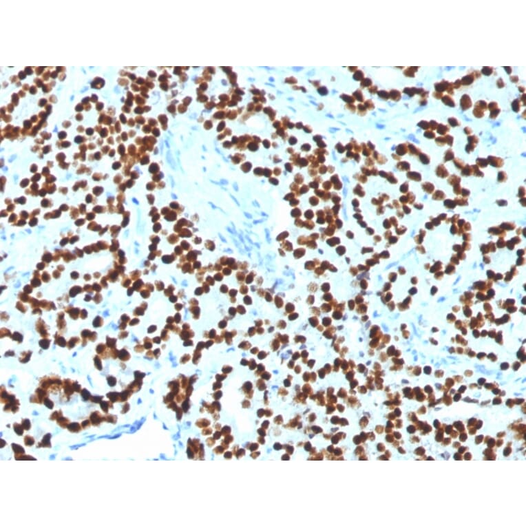 Immunohistochemistry - Anti-FOXA1 Antibody [FOXA1/1518] - BSA and Azide free (A252046) - Antibodies.com