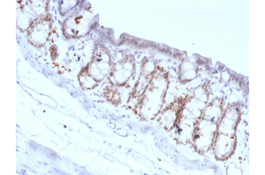 Immunohistochemistry - Anti-FOXA1 Antibody [FOXA1/1518] - BSA and Azide free (A252046) - Antibodies.com