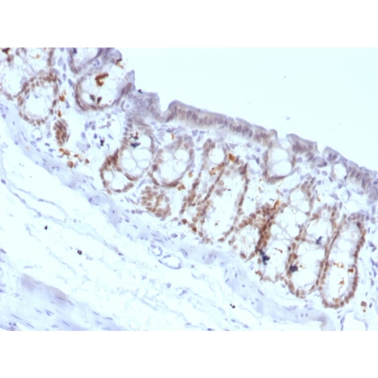 Immunohistochemistry - Anti-FOXA1 Antibody [FOXA1/1518] - BSA and Azide free (A252046) - Antibodies.com