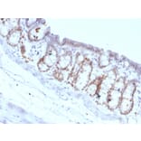 Immunohistochemistry - Anti-FOXA1 Antibody [FOXA1/1518] - BSA and Azide free (A252046) - Antibodies.com