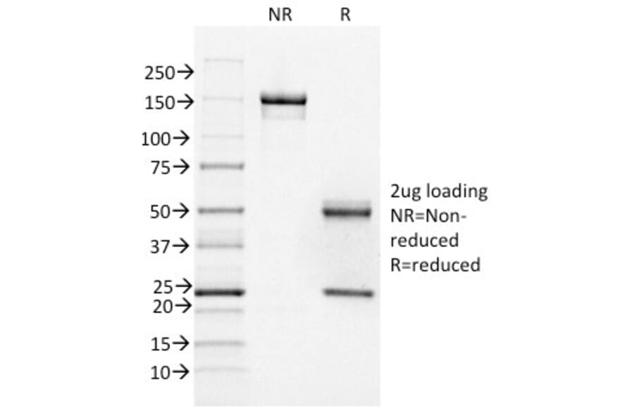 SDS-PAGE - Anti-FOXA1 Antibody [FOXA1/1518] - BSA and Azide free (A252046) - Antibodies.com