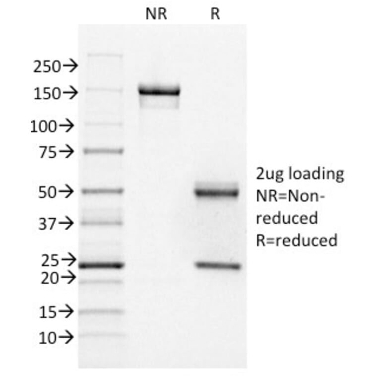 SDS-PAGE - Anti-FOXA1 Antibody [FOXA1/1518] - BSA and Azide free (A252046) - Antibodies.com