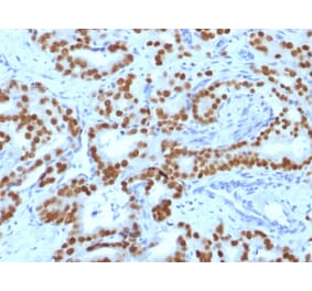 Immunohistochemistry - Anti-FOXA1 Antibody [FOXA1/1519] - BSA and Azide free (A252047) - Antibodies.com