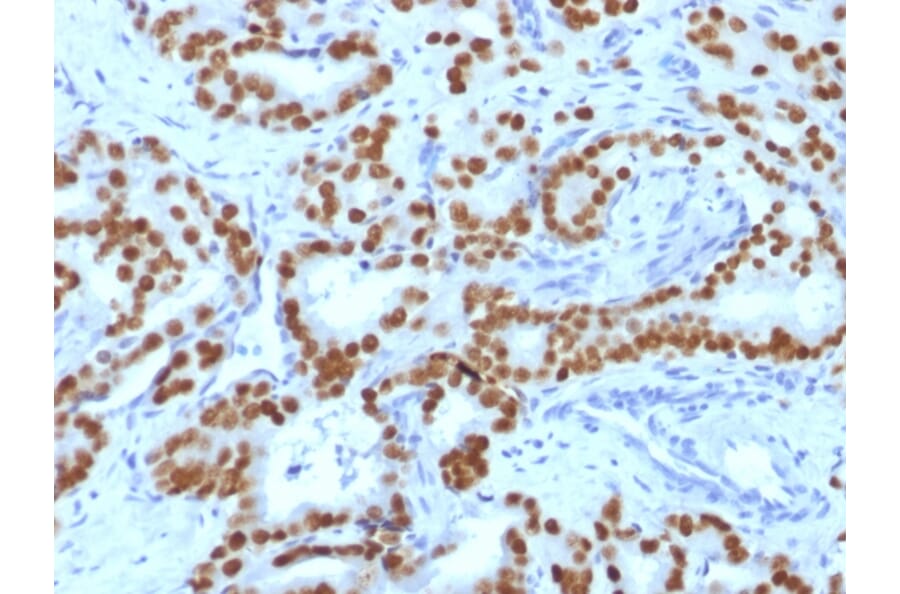 Immunohistochemistry - Anti-FOXA1 Antibody [FOXA1/1519] - BSA and Azide free (A252047) - Antibodies.com
