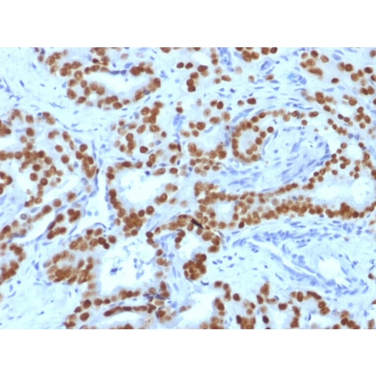 Immunohistochemistry - Anti-FOXA1 Antibody [FOXA1/1519] - BSA and Azide free (A252047) - Antibodies.com