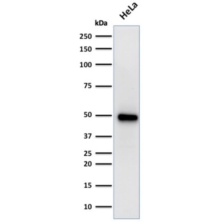 Western Blot - Anti-FOXA1 Antibody [FOXA1/1519] - BSA and Azide free (A252047) - Antibodies.com