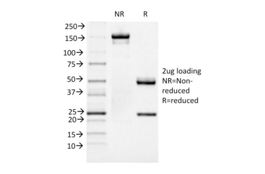 SDS-PAGE - Anti-FOXA1 Antibody [FOXA1/1519] - BSA and Azide free (A252047) - Antibodies.com