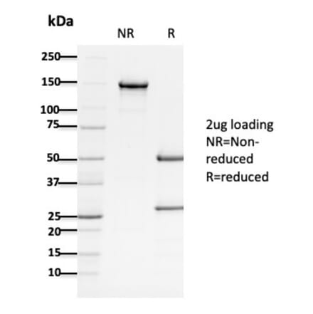 SDS-PAGE - Anti-APC Antibody [ALi 12-28] - BSA and Azide free (A252048) - Antibodies.com