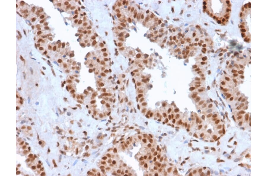 Immunohistochemistry - Anti-APE1 Antibody [CPTC-APEX1-2] - BSA and Azide free (A252051) - Antibodies.com
