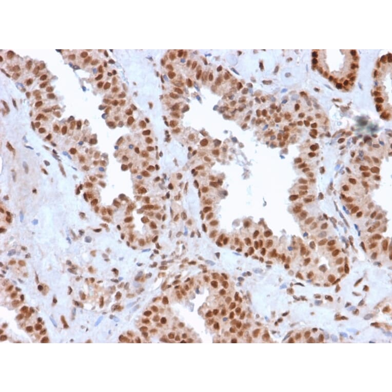Immunohistochemistry - Anti-APE1 Antibody [CPTC-APEX1-2] - BSA and Azide free (A252051) - Antibodies.com