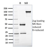 SDS-PAGE - Anti-APE1 Antibody [CPTC-APEX1-2] - BSA and Azide free (A252051) - Antibodies.com