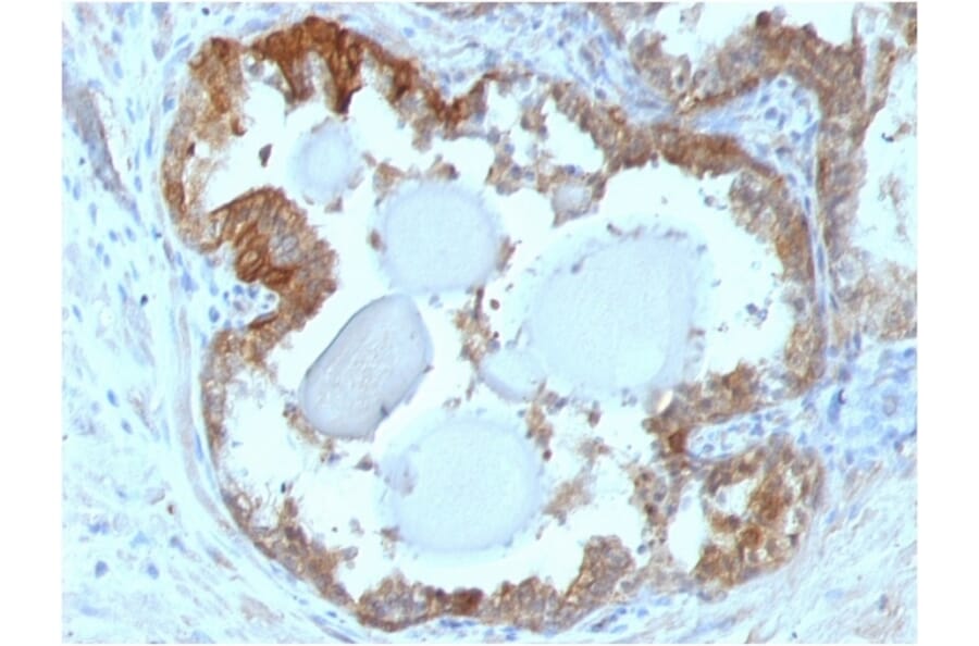Immunohistochemistry - Anti-HSP27 Antibody [G3.1] - BSA and Azide free (A252052) - Antibodies.com