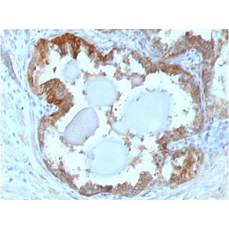 Immunohistochemistry - Anti-HSP27 Antibody [G3.1] - BSA and Azide free (A252052) - Antibodies.com