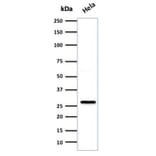 Western Blot - Anti-HSP27 Antibody [SPM252] - BSA and Azide free (A252053) - Antibodies.com
