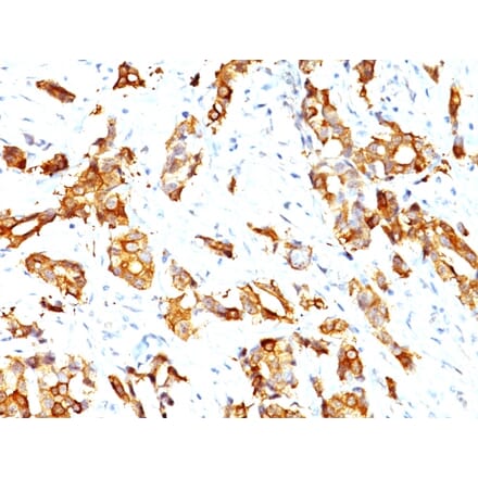 Immunohistochemistry - Anti-HSP27 Antibody [HSPB1/774] - BSA and Azide free (A252054) - Antibodies.com