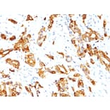 Immunohistochemistry - Anti-HSP27 Antibody [HSPB1/774] - BSA and Azide free (A252054) - Antibodies.com