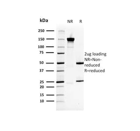 SDS-PAGE - Anti-HSP27 Antibody [CPTC-HSPB1-2] - BSA and Azide free (A252055) - Antibodies.com