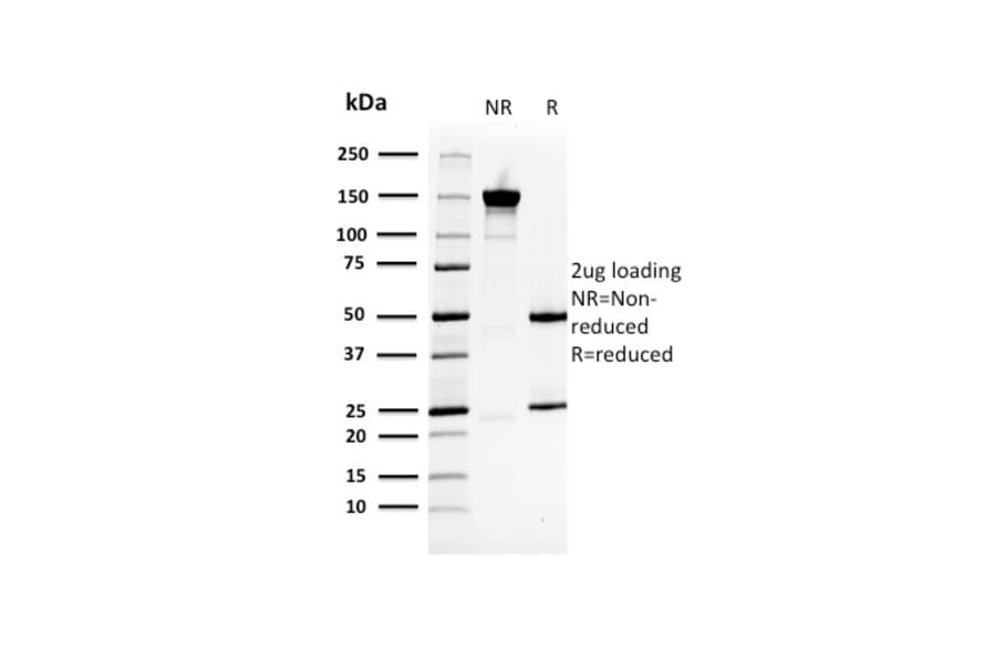 SDS-PAGE - Anti-HSP27 Antibody [CPTC-HSPB1-2] - BSA and Azide free (A252055) - Antibodies.com