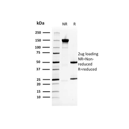SDS-PAGE - Anti-HSP27 Antibody [CPTC-HSPB1-2] - BSA and Azide free (A252055) - Antibodies.com