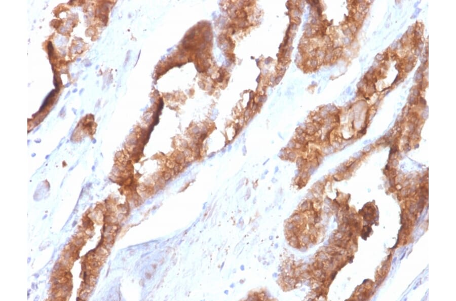 Immunohistochemistry - Anti-HSP27 Antibody [CPTC-HSPB1-2] - BSA and Azide free (A252055) - Antibodies.com