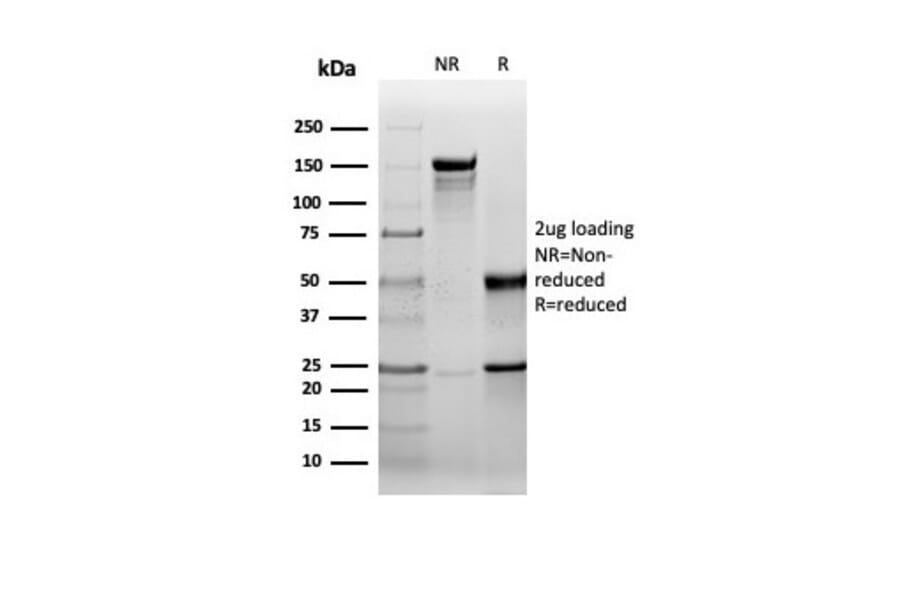 SDS-PAGE - Anti-HSP27 Antibody [rHSPB1/6489] - BSA and Azide free (A252056) - Antibodies.com