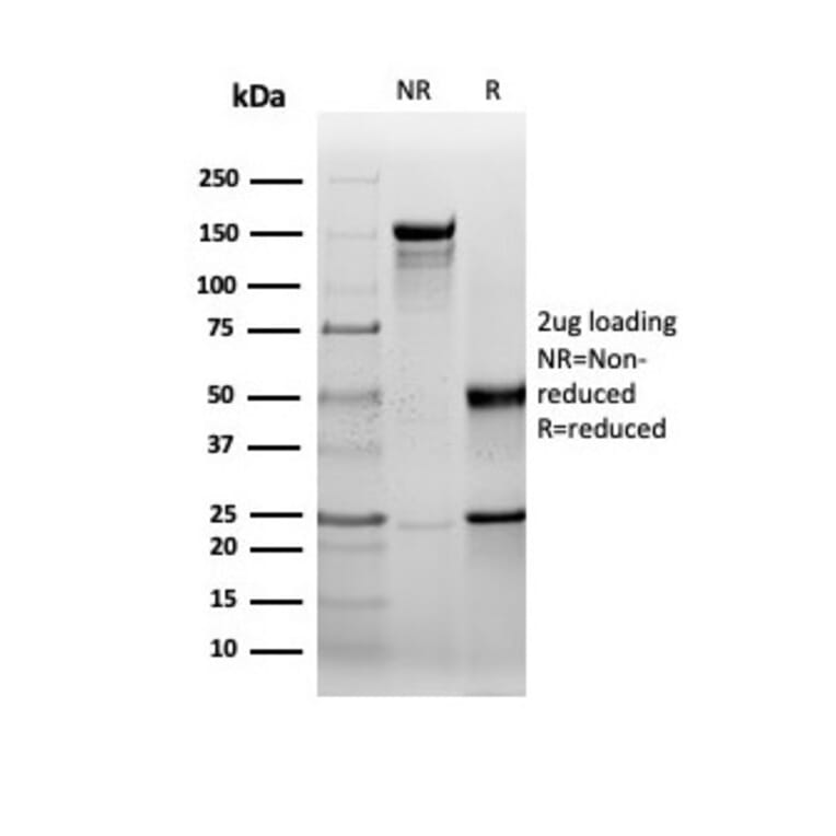 SDS-PAGE - Anti-HSP27 Antibody [rHSPB1/6489] - BSA and Azide free (A252056) - Antibodies.com