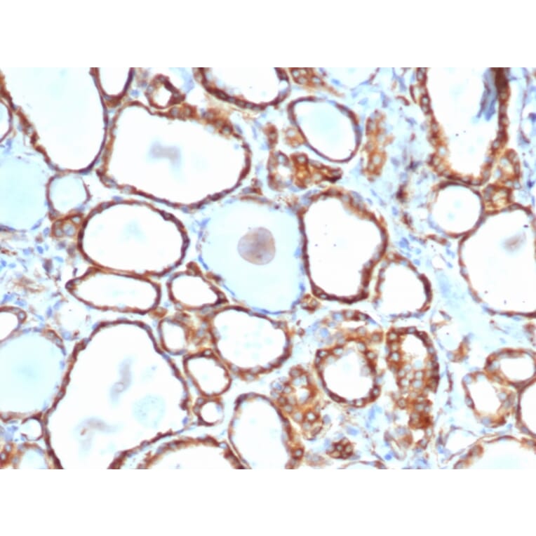 Immunohistochemistry - Anti-HSP27 Antibody [rHSPB1/6489] - BSA and Azide free (A252055) - Antibodies.com