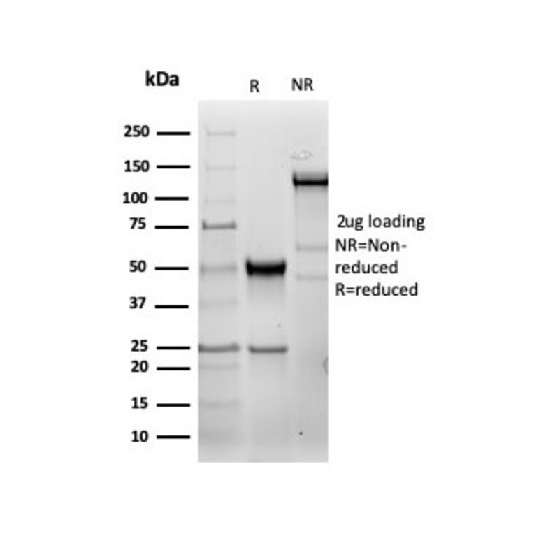 SDS-PAGE - Anti-HSP27 Antibody [HSPB1/6490R] - BSA and Azide free (A252057) - Antibodies.com