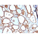 Immunohistochemistry - Anti-HSP27 Antibody [HSPB1/6490R] - BSA and Azide free (A252056) - Antibodies.com