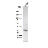 Western Blot - Anti-HSP27 Antibody [HSPB1/6490R] - BSA and Azide free (A252057) - Antibodies.com