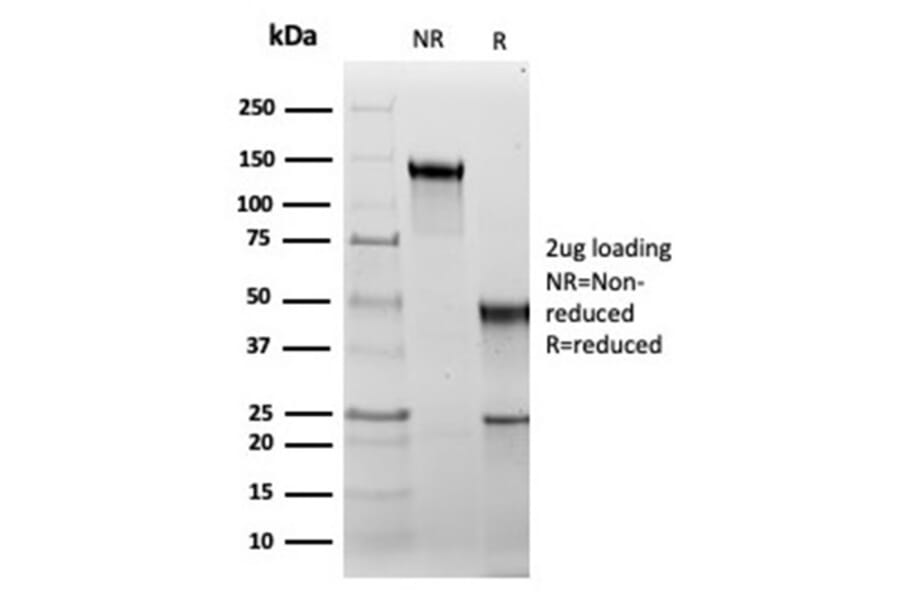SDS-PAGE - Anti-HSP60 Antibody [rHSPD1/6495] - BSA and Azide free (A252062) - Antibodies.com