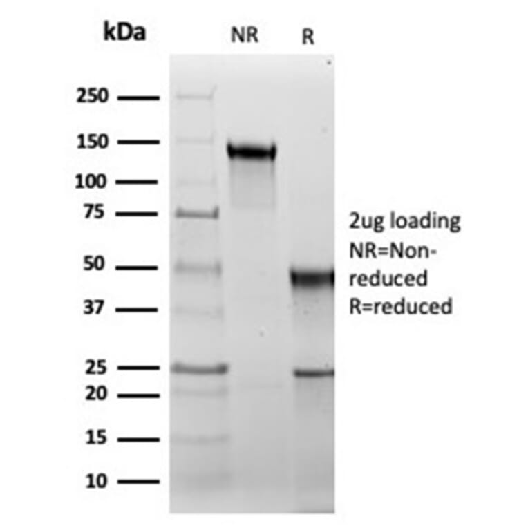 SDS-PAGE - Anti-HSP60 Antibody [rHSPD1/6495] - BSA and Azide free (A252062) - Antibodies.com