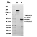 SDS-PAGE - Anti-HSP60 Antibody [rHSPD1/6495] - BSA and Azide free (A252062) - Antibodies.com