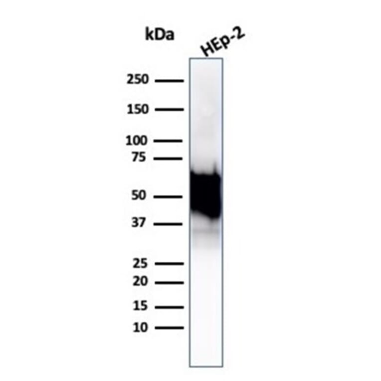 Western Blot - Anti-HSP60 Antibody [rHSPD1/6495] - BSA and Azide free (A252062) - Antibodies.com