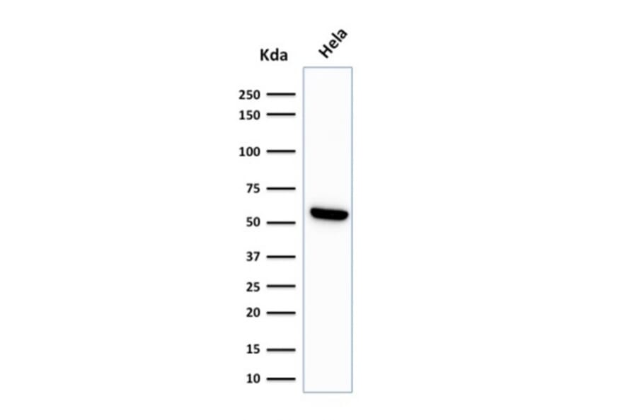 Western Blot - Anti-HSP60 Antibody [LK1] - BSA and Azide free (A252063) - Antibodies.com