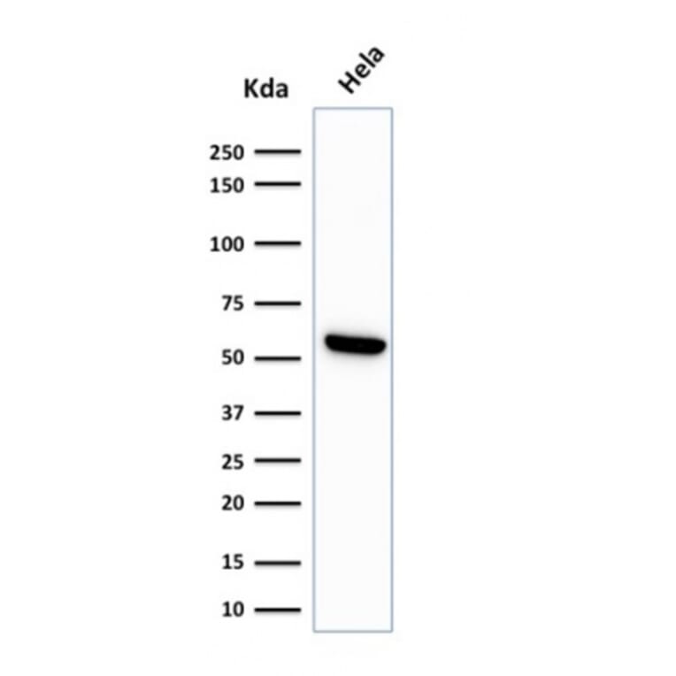 Western Blot - Anti-HSP60 Antibody [LK1] - BSA and Azide free (A252063) - Antibodies.com