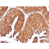 Immunohistochemistry - Anti-HSP60 Antibody [SPM253] - BSA and Azide free (A252064) - Antibodies.com