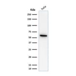 Western Blot - Anti-HSP60 Antibody [SPM253] - BSA and Azide free (A252064) - Antibodies.com
